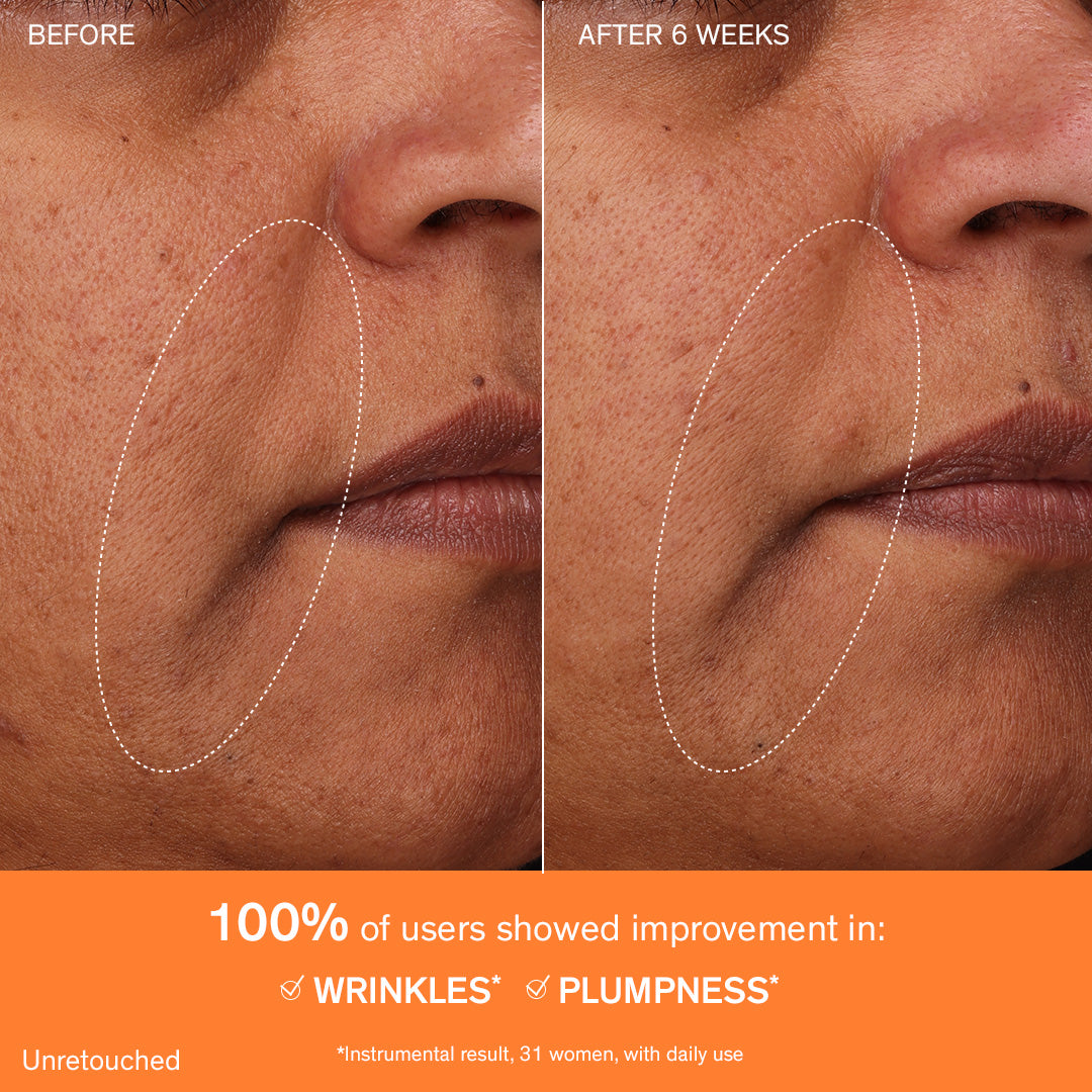 Concentrated Ginseng Rejuvenating Cream, instrumental results for improvement in wrinkles and plumpness