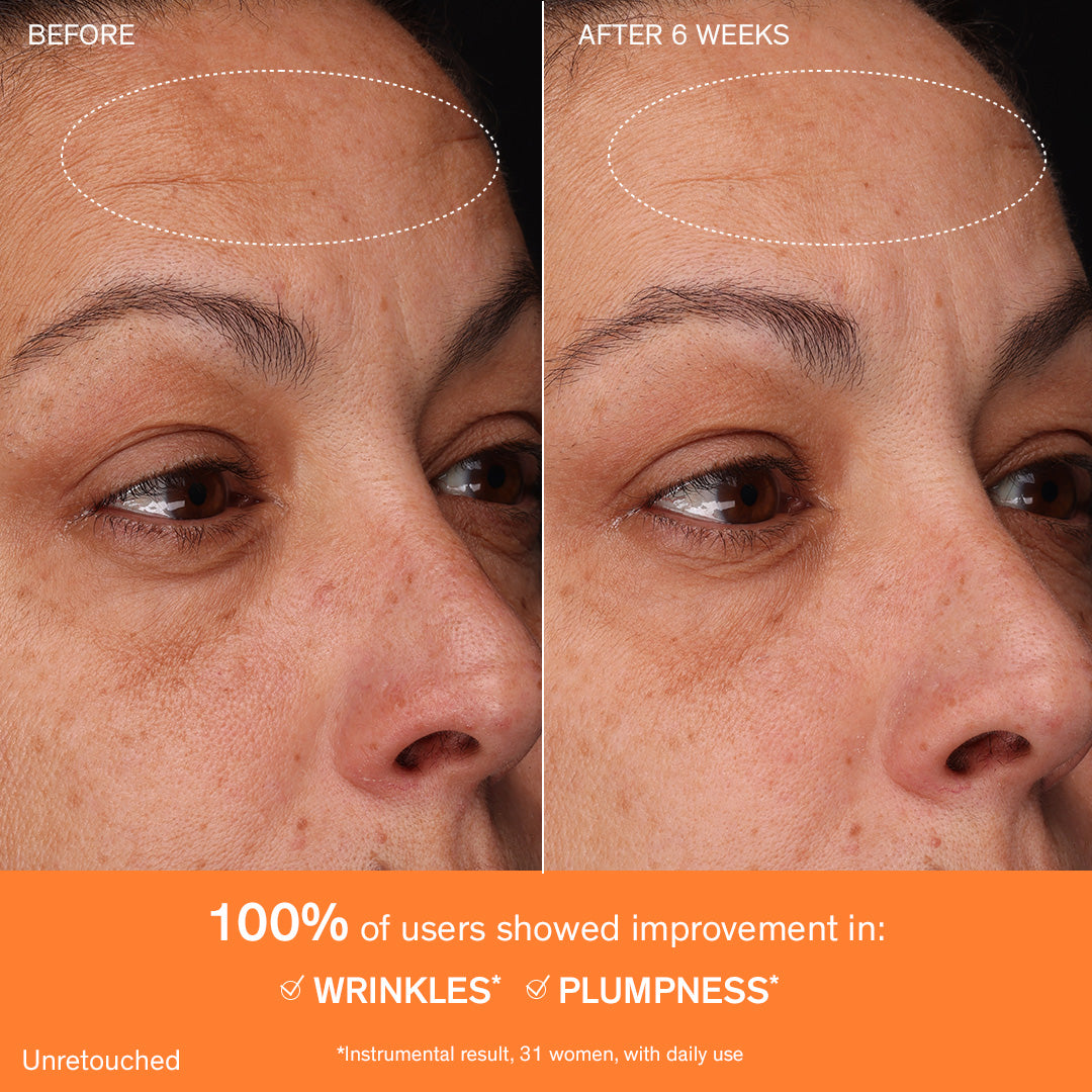 Concentrated Ginseng Rejuvenating Cream, instrumental result for improvement in wrinkles and plumpness after 6 weeks of use