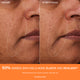 Enlarge image of Before and after comparison of skin elasticity with a visible improvement.