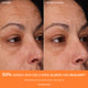 Enlarge image of Before and after comparison of skin elasticity with text indicating improvement.