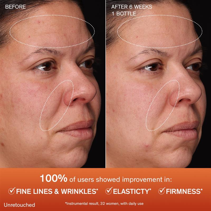 Concentrated Ginseng Renjuvenating Serum, before and after image after 6 weeks of use 