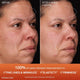Enlarge image of Concentrated Ginseng Renjuvenating Serum, before and after image after 6 weeks of use 