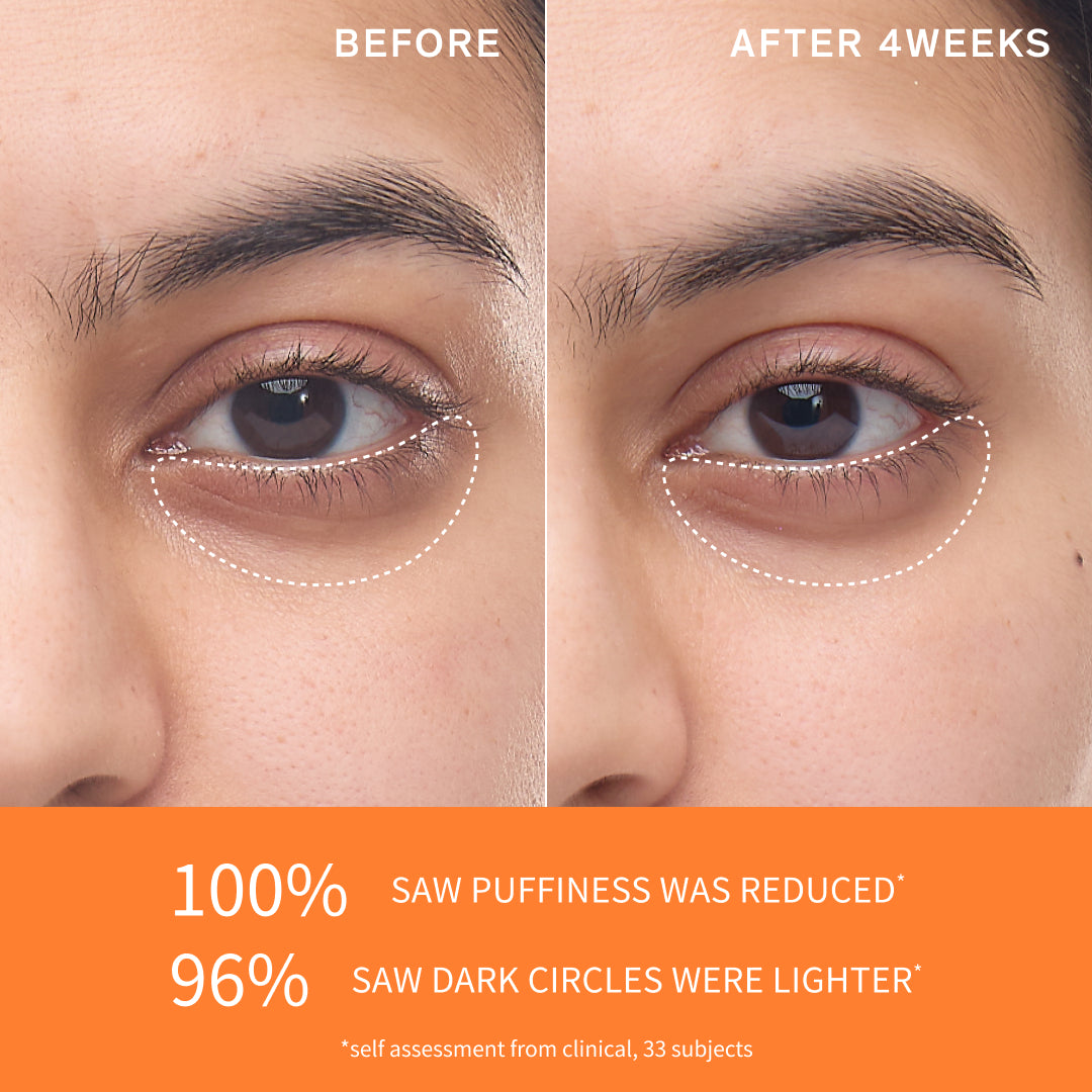 Before and after image of under eye area after 4 weeks of use 