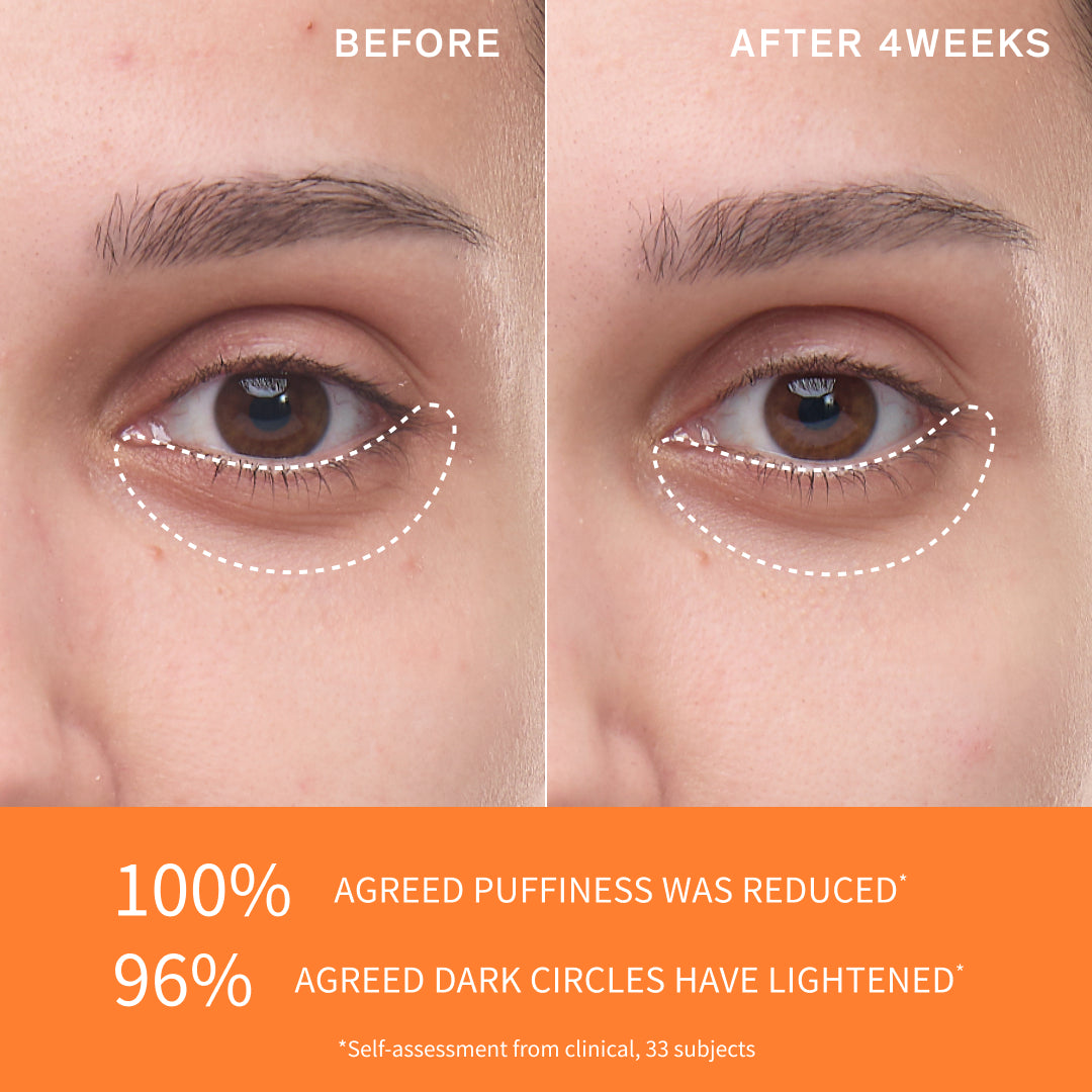 Before and after image of under eye area after 4 weeks of use 