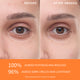 Enlarge image of Before and after image of under eye area after 4 weeks of use 