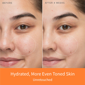 First Care Activating Serum VI Set