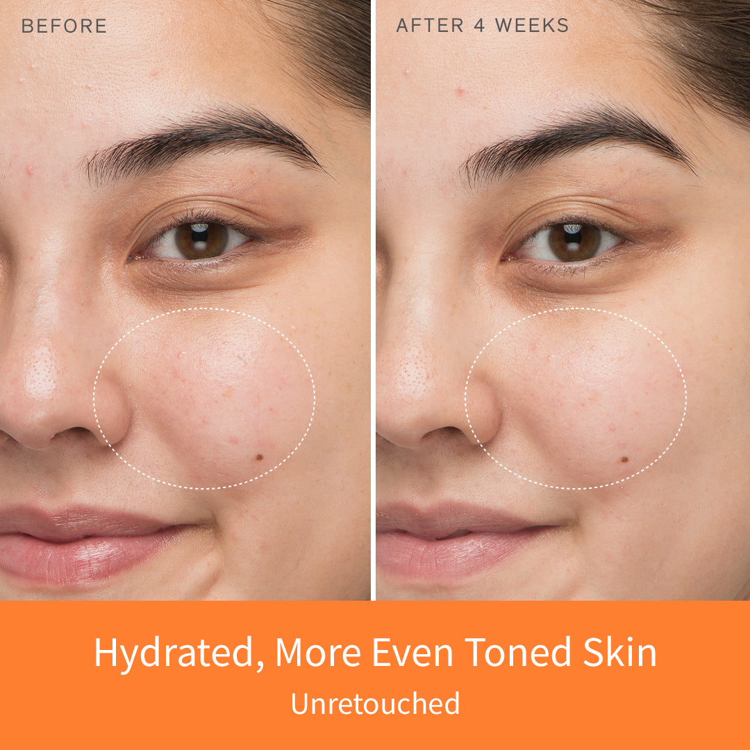 Sulwhasoo 雪花秀 First Care Serum VI Set First Care Activating Serum VI | Top Anti Aging Serum