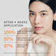 Enlarge image of Woman with moisturized lips after 4 weeks of product application, showing text about product effects.