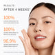 Enlarge image of Advertisement showing a woman&amp;#39;s face with skincare results after 4 weeks.