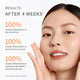 Enlarge image of Advertisement showing a woman&amp;#39;s face with skincare results after 4 weeks.