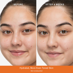 Before & after comparison after 4 weeks featuring hydrated, more even toned skin