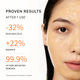 Enlarge image of Proven results after 1 use